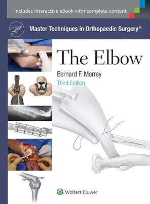 Master Techniques in Orthopaedic Surgery: The Elbow.Hardcover,By :Morrey, Bernard F., MD